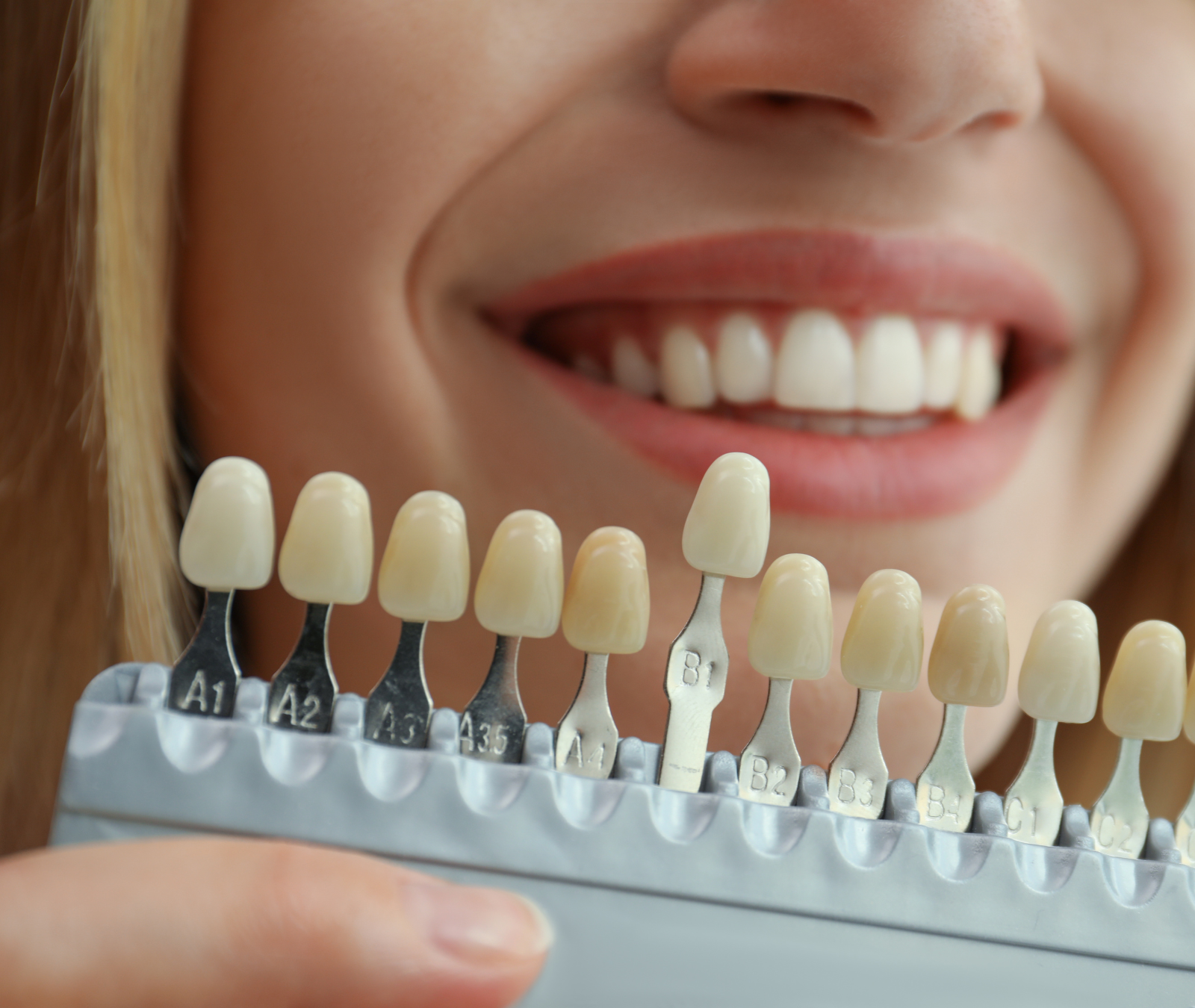 Dental Care in Wilmslow | Expert Treatments & Invisible Teeth Aligners at Wilmslow Dental Centre